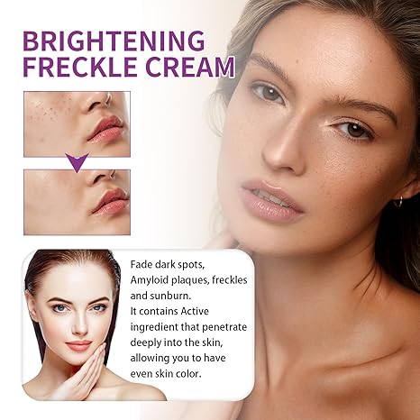Spot Fading Urea ,Dark Spot Reducing,ππ‘π’πππ§π’π§π and π
π«πππ€π₯π Removal Cream