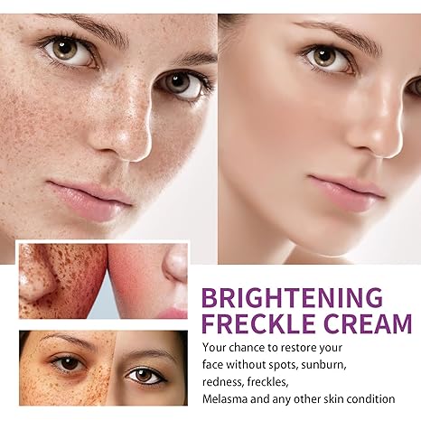 Spot Fading Urea ,Dark Spot Reducing,ππ‘π’πππ§π’π§π and π
π«πππ€π₯π Removal Cream