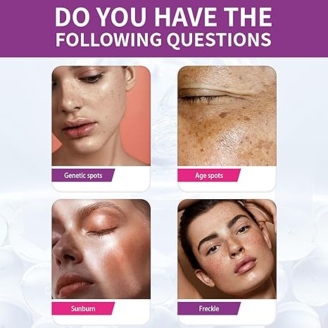 Spot Fading Urea ,Dark Spot Reducing,ππ‘π’πππ§π’π§π and π
π«πππ€π₯π Removal Cream