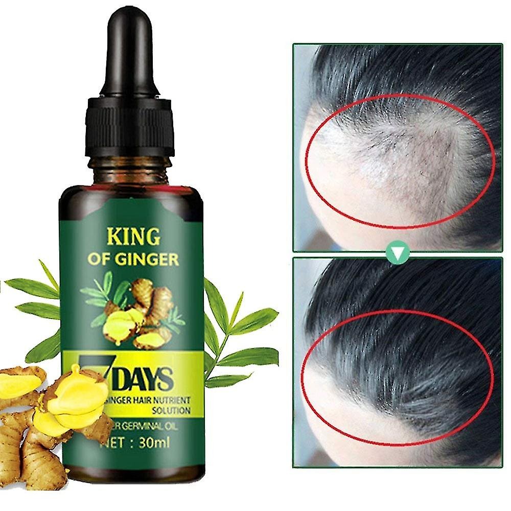 7 Days Ginger Germinal Oil - Hair Regrowth Serum 30ml