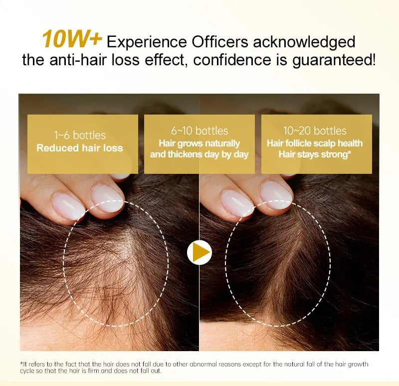 7 Days Ginger Germinal Oil - Hair Regrowth Serum 30ml