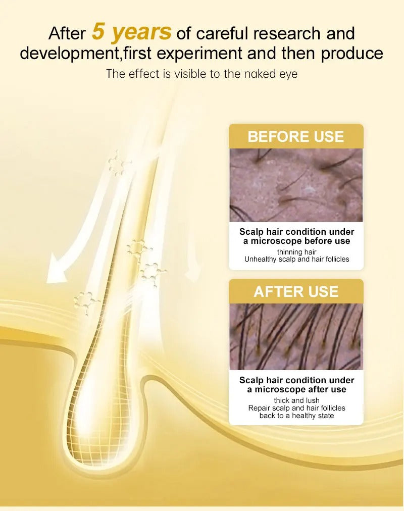 7 Days Ginger Germinal Oil - Hair Regrowth Serum 30ml