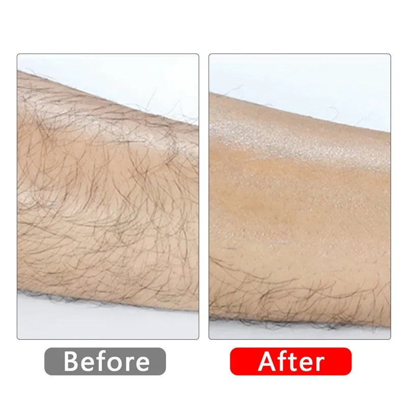 Painless Crystal Hair Remover Imported