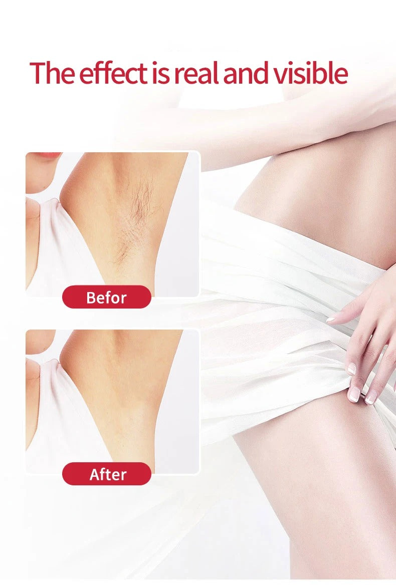 Rechargeable Flawless hair remover Facial Hair Removal Machine