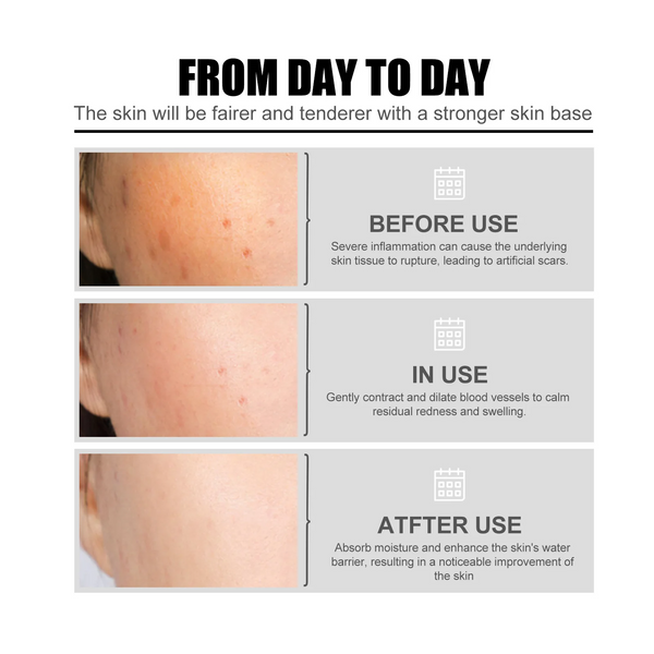 The Ordinary Niacinamide 10% + Zinc 1% 30ml Serum For All Skin Types