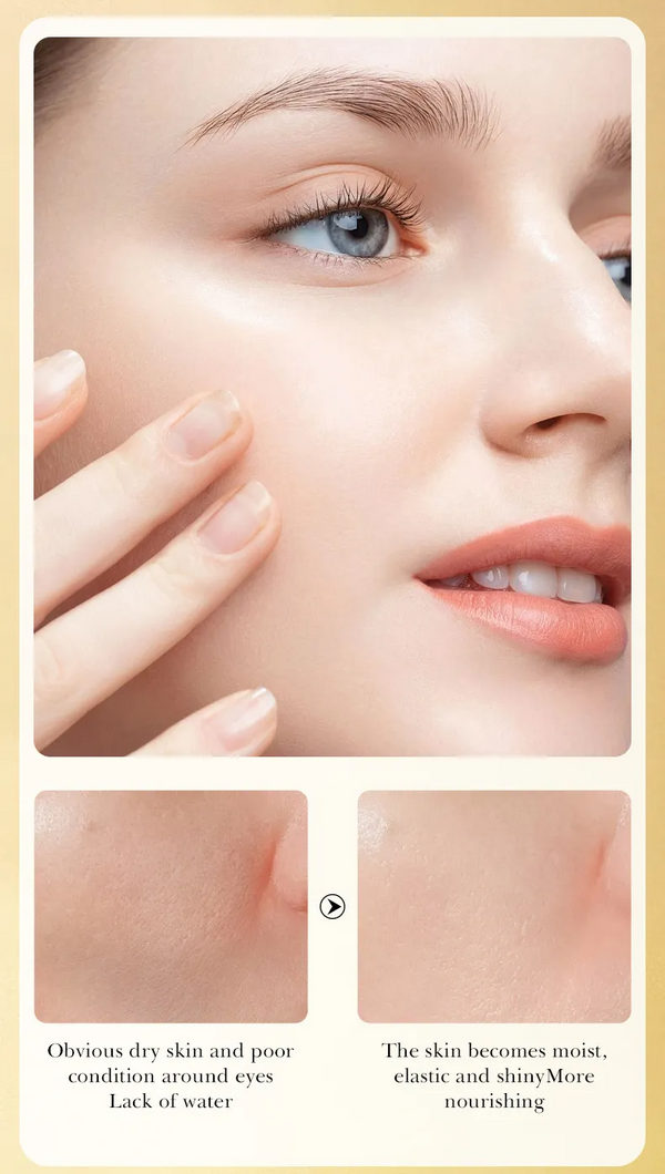 The Ordinary Niacinamide 10% + Zinc 1% 30ml Serum For All Skin Types