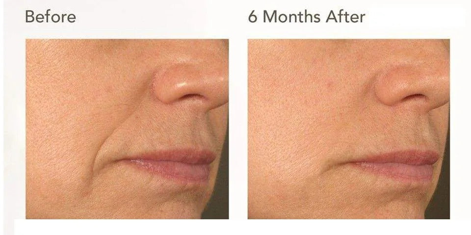 Rorec Rice Skin Beauty Serum