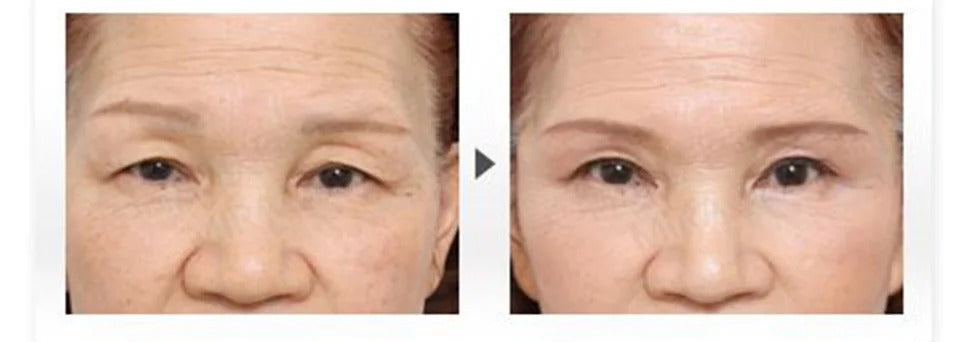 Rorec Rice Skin Beauty Serum