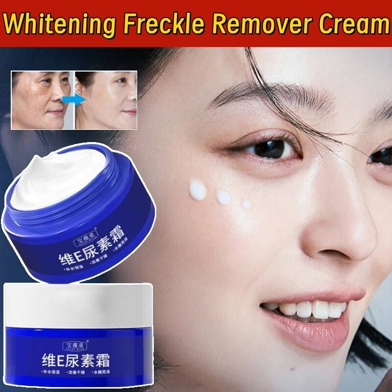 Spot Fading Urea ,Dark Spot Reducing,ππ‘π’πππ§π’π§π and π
π«πππ€π₯π Removal Cream