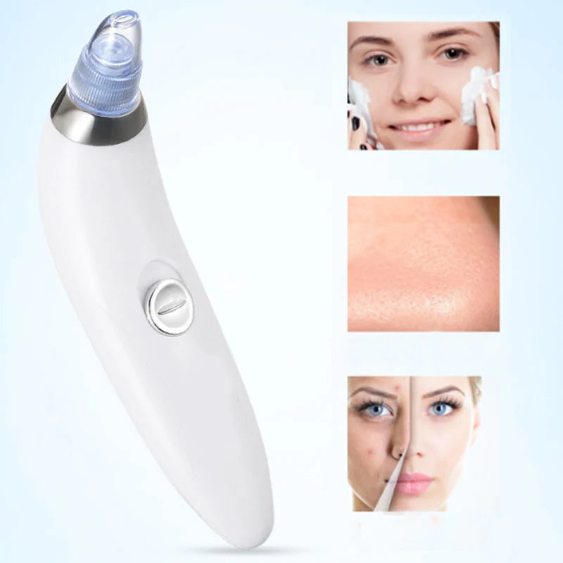 Derma Suction Blackhead Remover Device