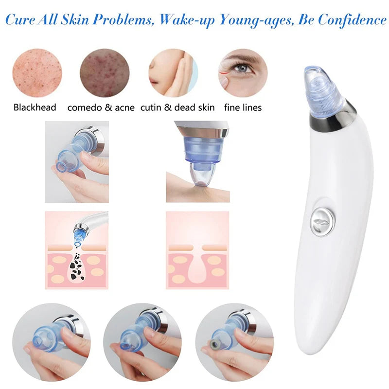Derma Suction Blackhead Remover Device