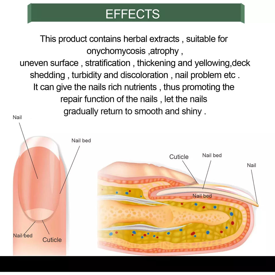 Fast Nail Fungal Treatments Nail Repair Essences Serum
