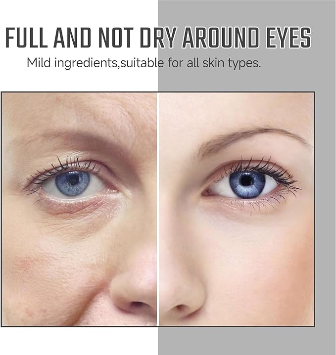 VC Rapid Reduction Eye Essence Oil, Anti-Aging Eye Serum Oil for Eye Bags & Dark