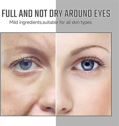 VC Rapid Reduction Eye Essence Oil, Anti-Aging Eye Serum Oil for Eye Bags & Dark