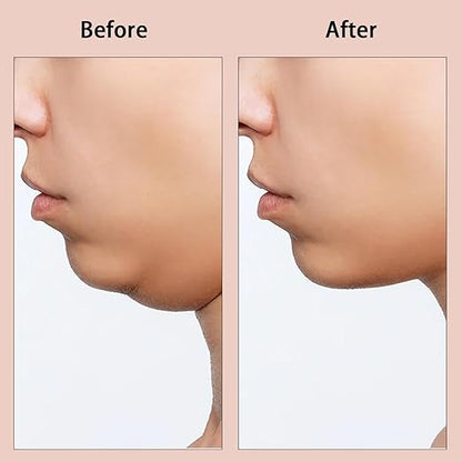 V Shaped Face Lifting & Contouring Face Mask