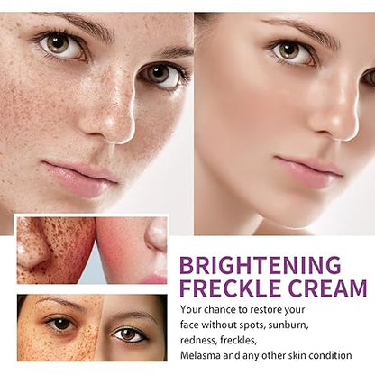 Spot Fading Urea ,Dark Spot Reducing,𝐖𝐡𝐢𝐭𝐞𝐧𝐢𝐧𝐠 and 𝐅𝐫𝐞𝐜𝐤𝐥𝐞 Removal Cream