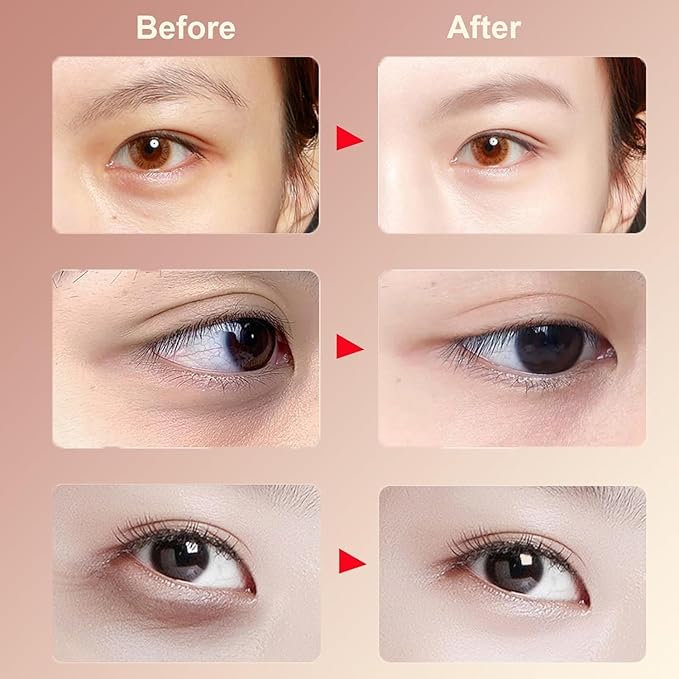 VC Rapid Reduction Eye Essence Oil, Anti-Aging Eye Serum Oil for Eye Bags & Dark
