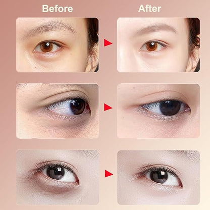 VC Rapid Reduction Eye Essence Oil, Anti-Aging Eye Serum Oil for Eye Bags & Dark