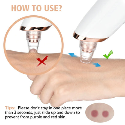 5 in 1 Rechargeable Blackheads Remover  & Cleaner
