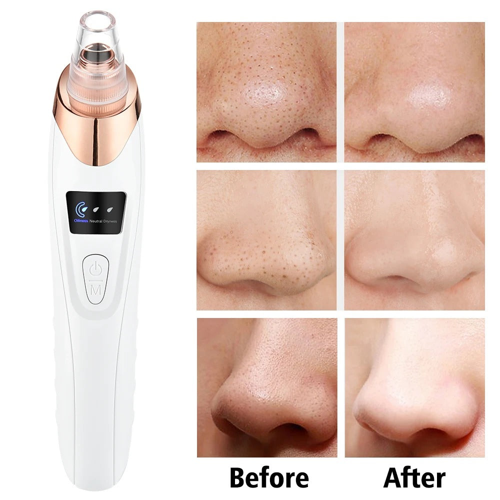 5 in 1 Rechargeable Blackheads Remover  & Cleaner