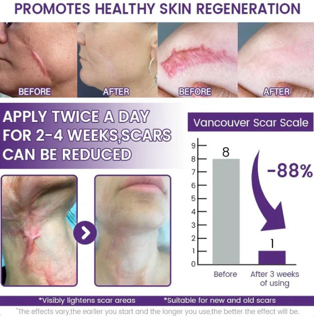 Timilk ReGenScar Stem Cell Repair Gel (Visible Scar Improvement in 7 Days)