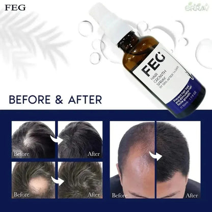 FEG Plus Hair Growth Spray – Stimulates Follicles & Reduces Hair Fall