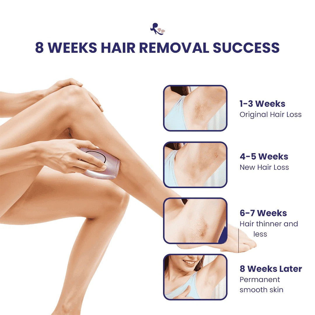IPL Portable Laser Hair Removal