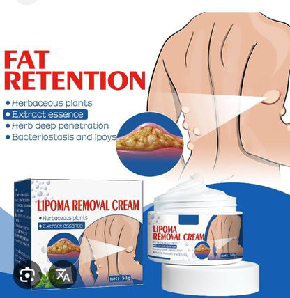 South Moon Lipoma Removal Cream
